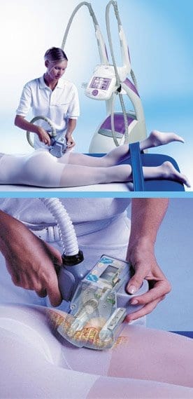 Image: Endermologie at Centers for Health Promotion, Inc.